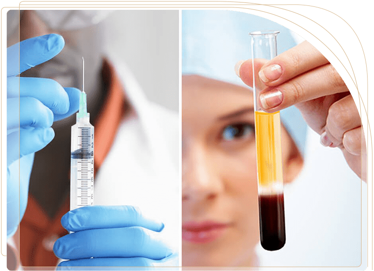 پی ار پی صورت