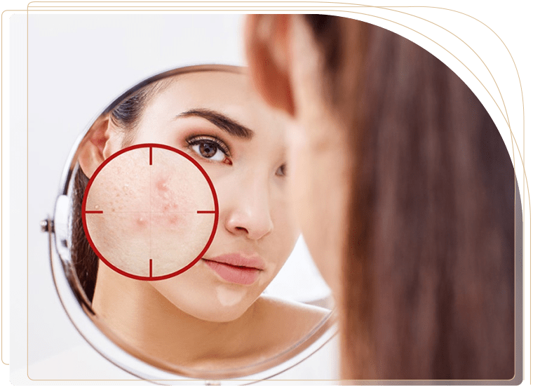 لیزر کیوسوئیچ