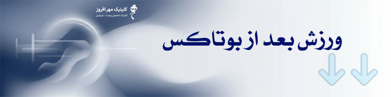 ورزش بعد از بوتاکس