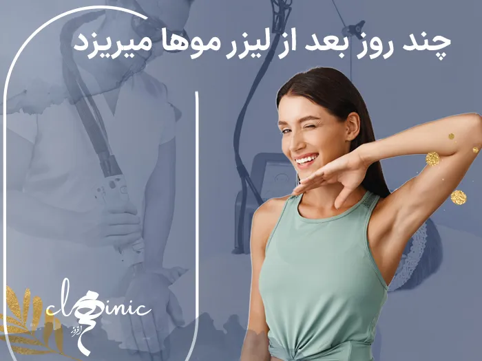 ریزش مو بعد لیزر