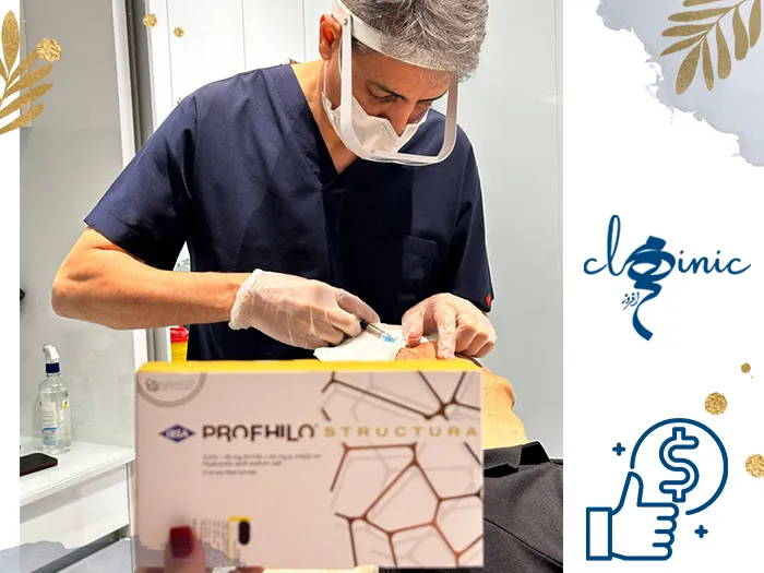 هزینه پروفایلو