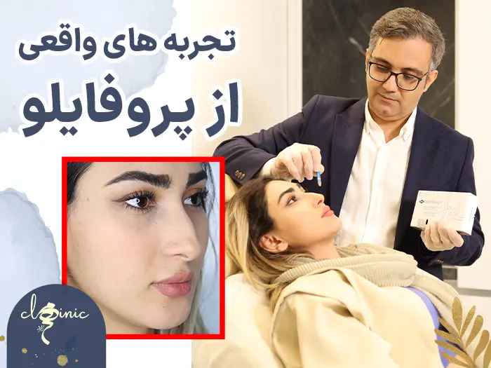 تجربه پروفایلو