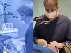 ماندگاری اندولیفت صورت