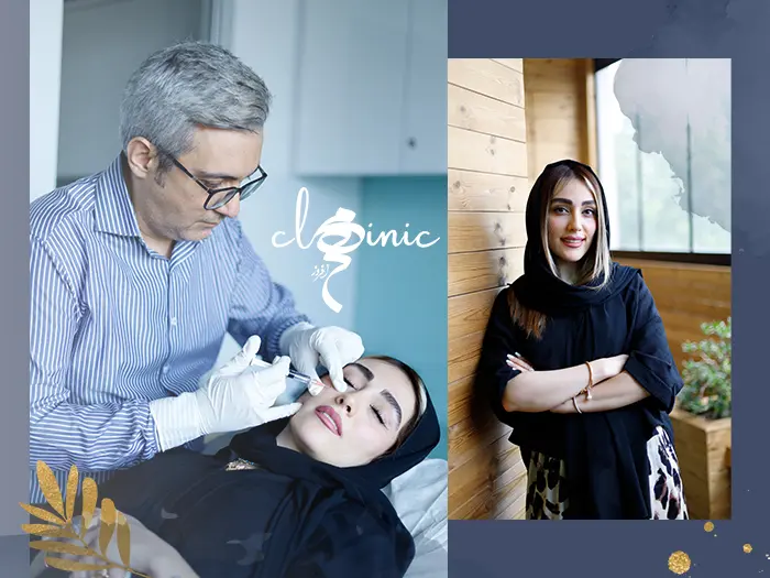 نظرات تزریق پروفایلو