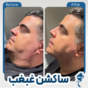 نمونه کار جراحی زیبایی