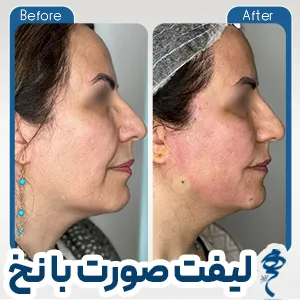 نمونه کار جوانسازی