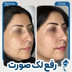 نمونه کار درمانی