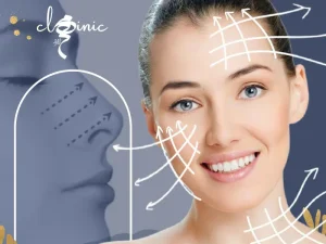 اندولیفت بینی