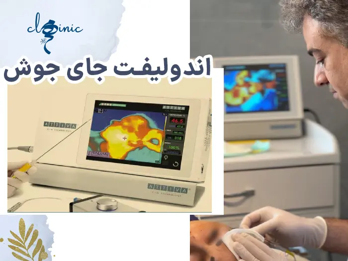 اندولیفت جوش