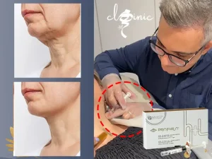 جوانسازی گردن