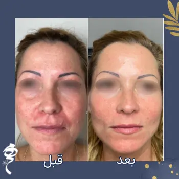 نمونه پروفایلو