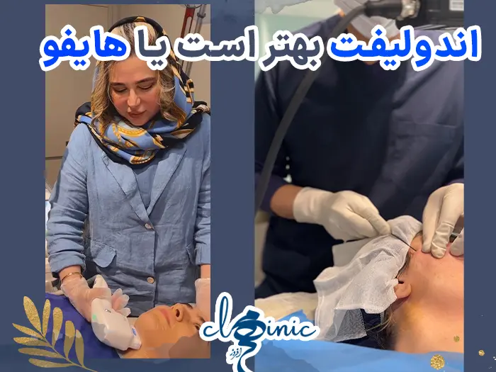 هایفوتراپی یا اندولیفت