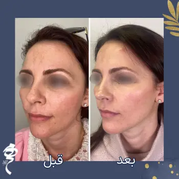 پروفایلو