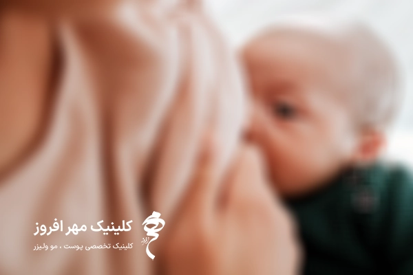 تزریق پروفایلو در دوران شیردهی