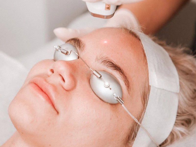 بهترین سن برای شروع درمان‌های جوانسازی صورت