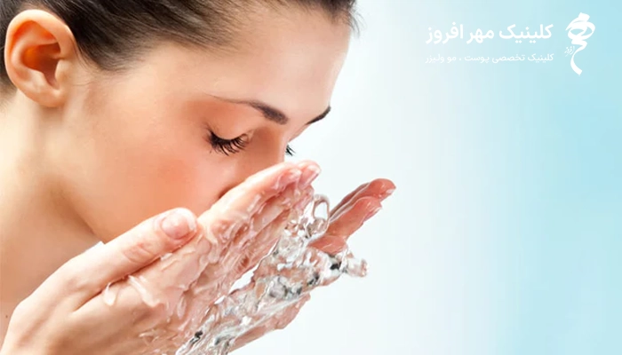 روش صحیح شستن صورت بعد از پروفایلو