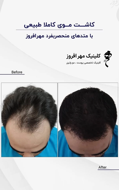 طبیعی بودن خط رویش