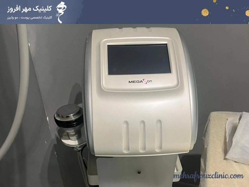 دستگاه لاغری کویتیشن