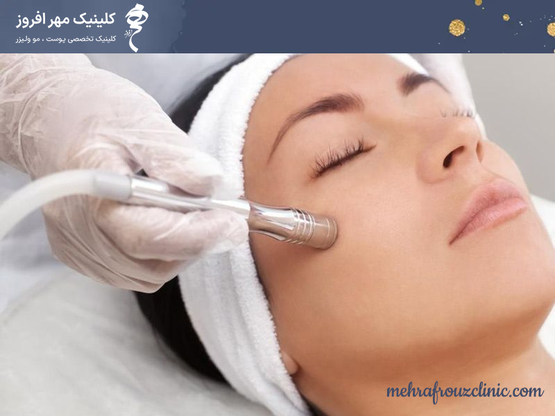میکرودرم ابریژن