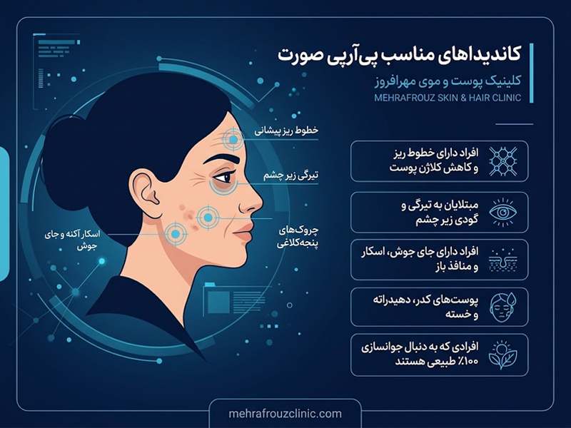 کاندید PRP صورت