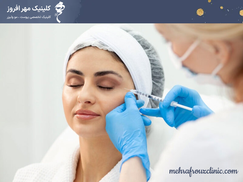 بیبی بوتاکس