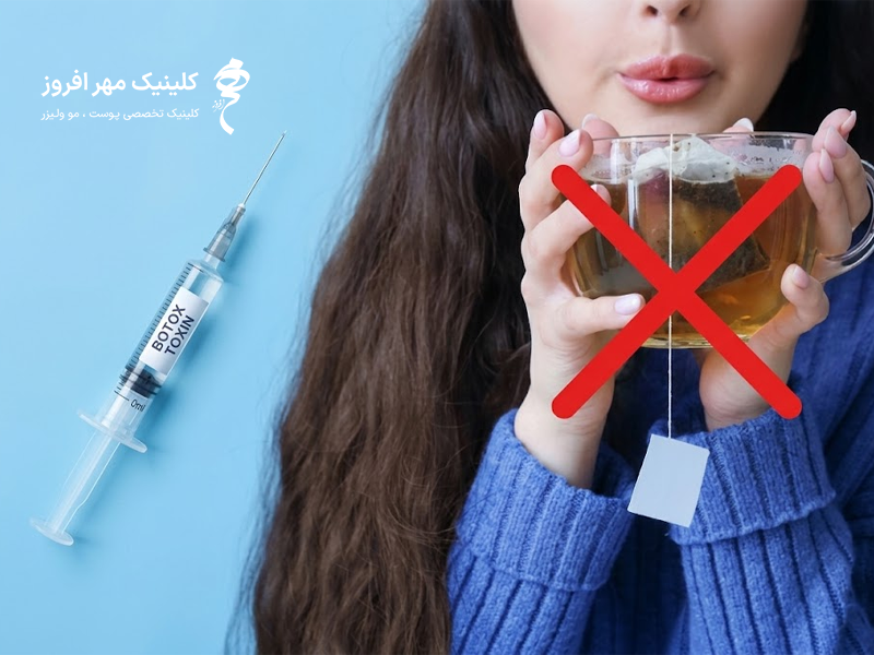 تاثیر چاب بر بوتاکس