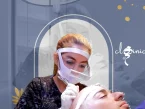 اقدامات بعد کاشت مو