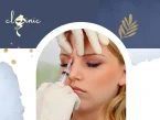 تزریق بوتاکس برای میگرن