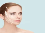 لیفت با نخ