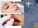 نحوه ماساژ بعد تزریق ژل لب
